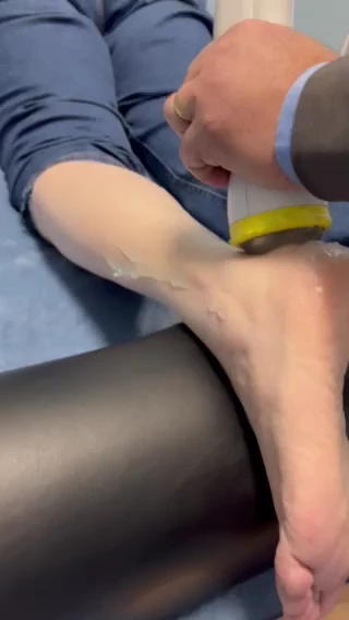 SoftWave treatment being applied to a patient’s heel